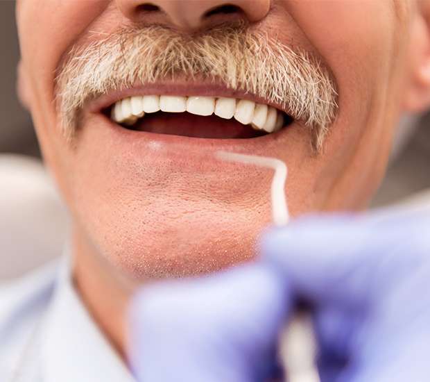 West Valley City Adjusting to New Dentures