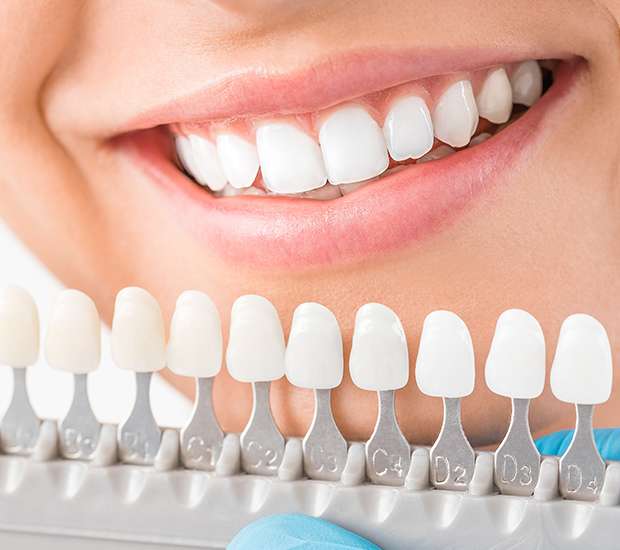 West Valley City Cosmetic Dentist