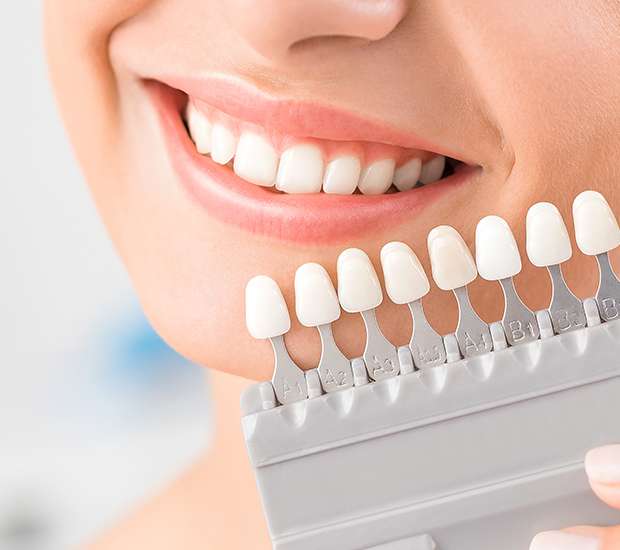 West Valley City Veneers