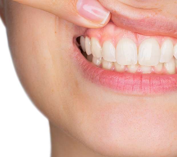 West Valley City Gum Disease