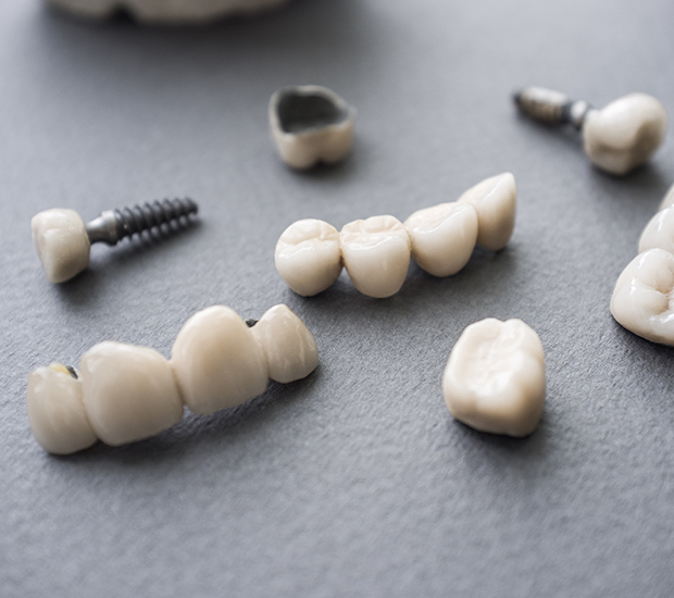 West Valley City The Difference Between Dental Implants and Mini Dental Implants