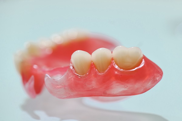 Options For Partial Dentures